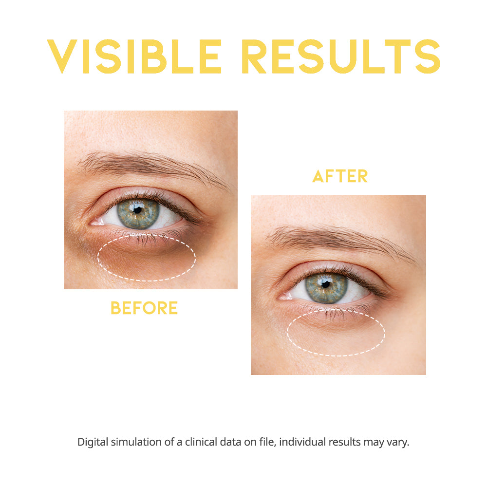 Dark Spot Vitamin C Serum