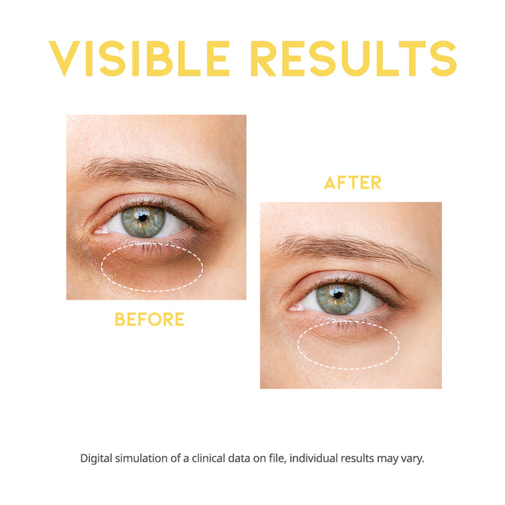 Dark Spot Vitamin C Serum