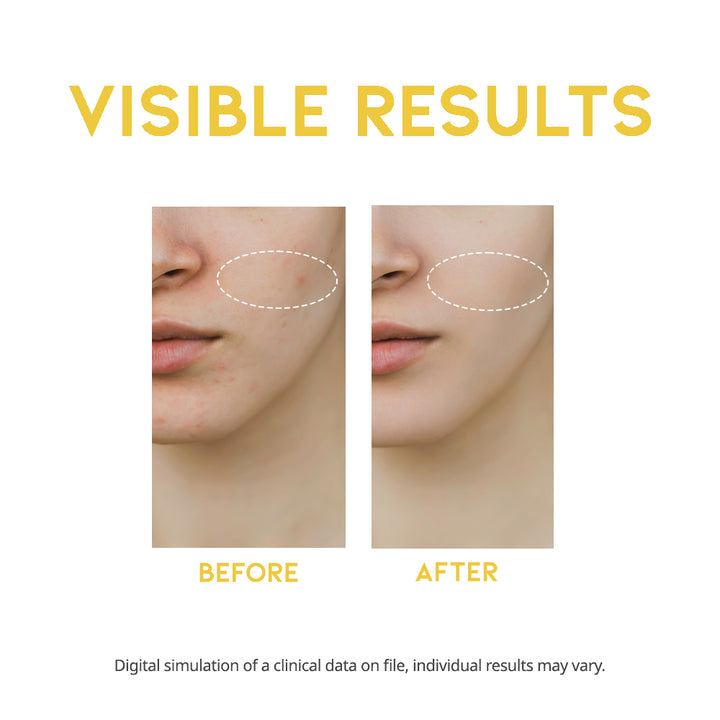 Dark Spot Vitamin C Serum