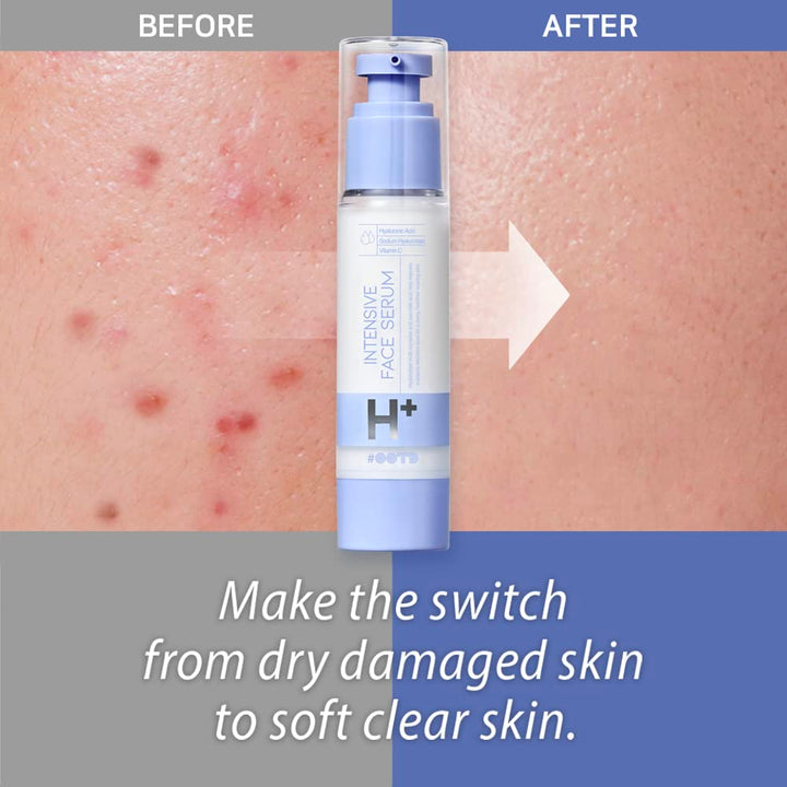 Intensive Moisture Face Serum