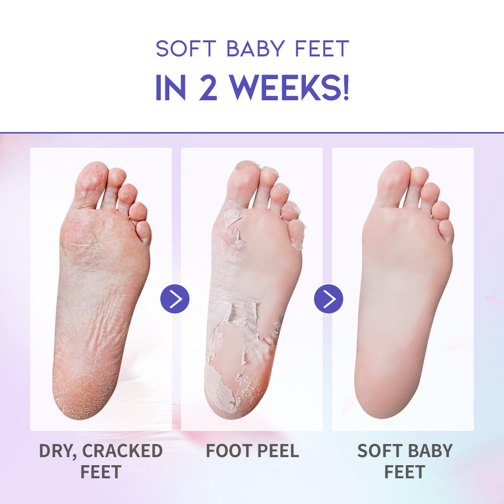 Foot Peel Mask