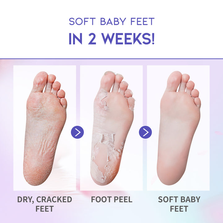 Foot Peel Mask