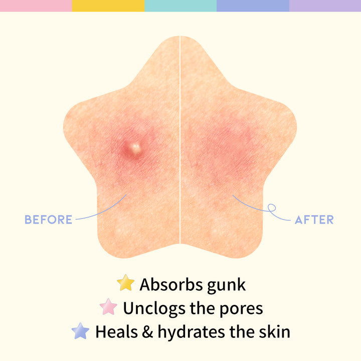 How to Use Star Sopt Patch