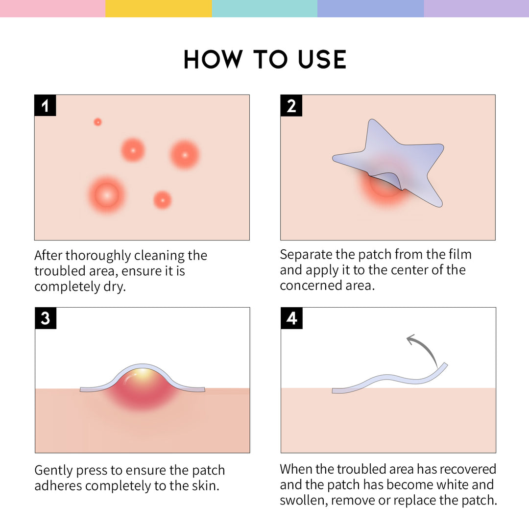 How to Use Star Sopt Patch