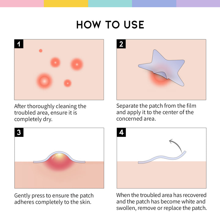 How to Use Star Sopt Patch