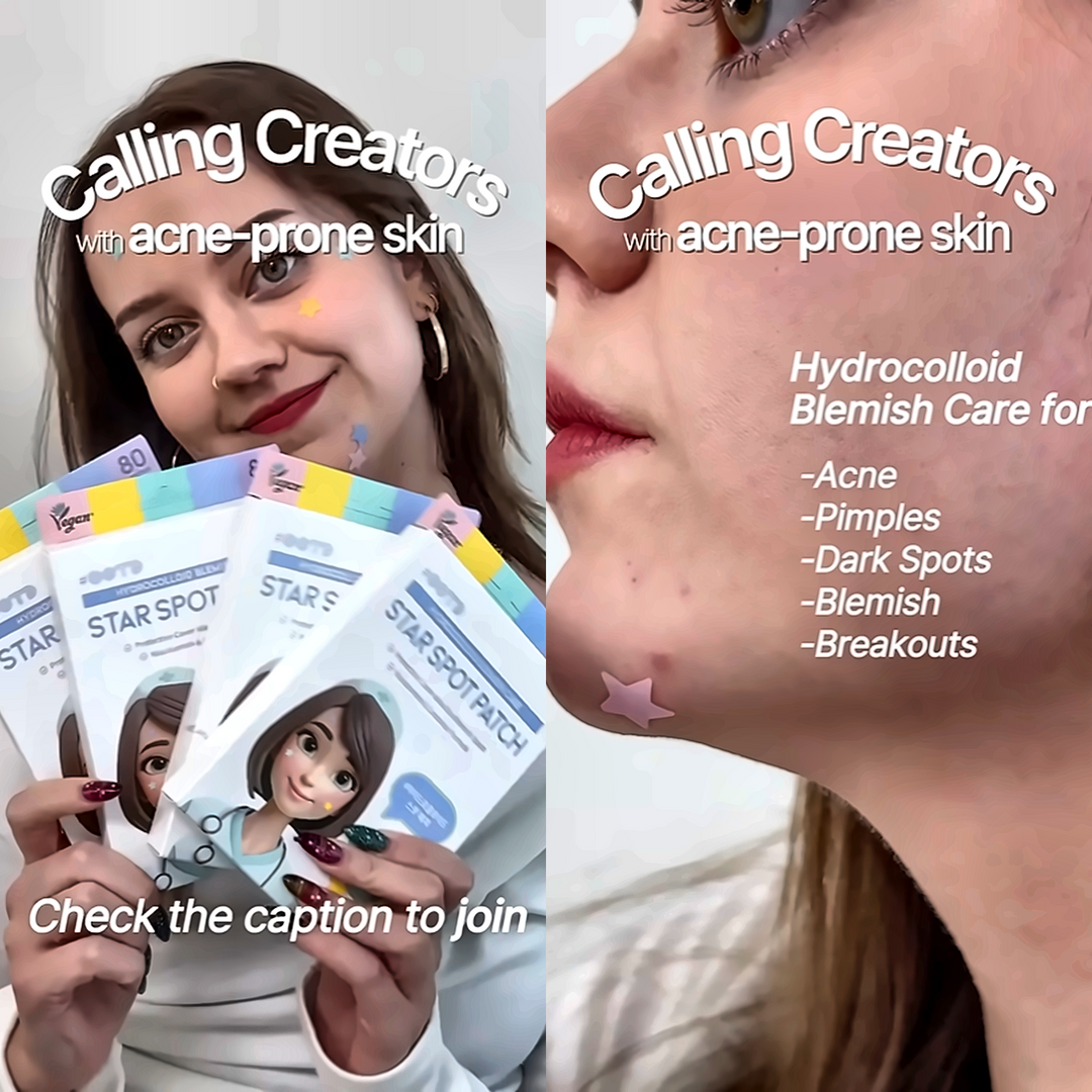 OTD Beauty Calling Creators with acne-prone skin campaign — creator wearing star shaped acne patch hydrocolloid blemish care K-beauty for acne star spot patch acne prone skin skincare