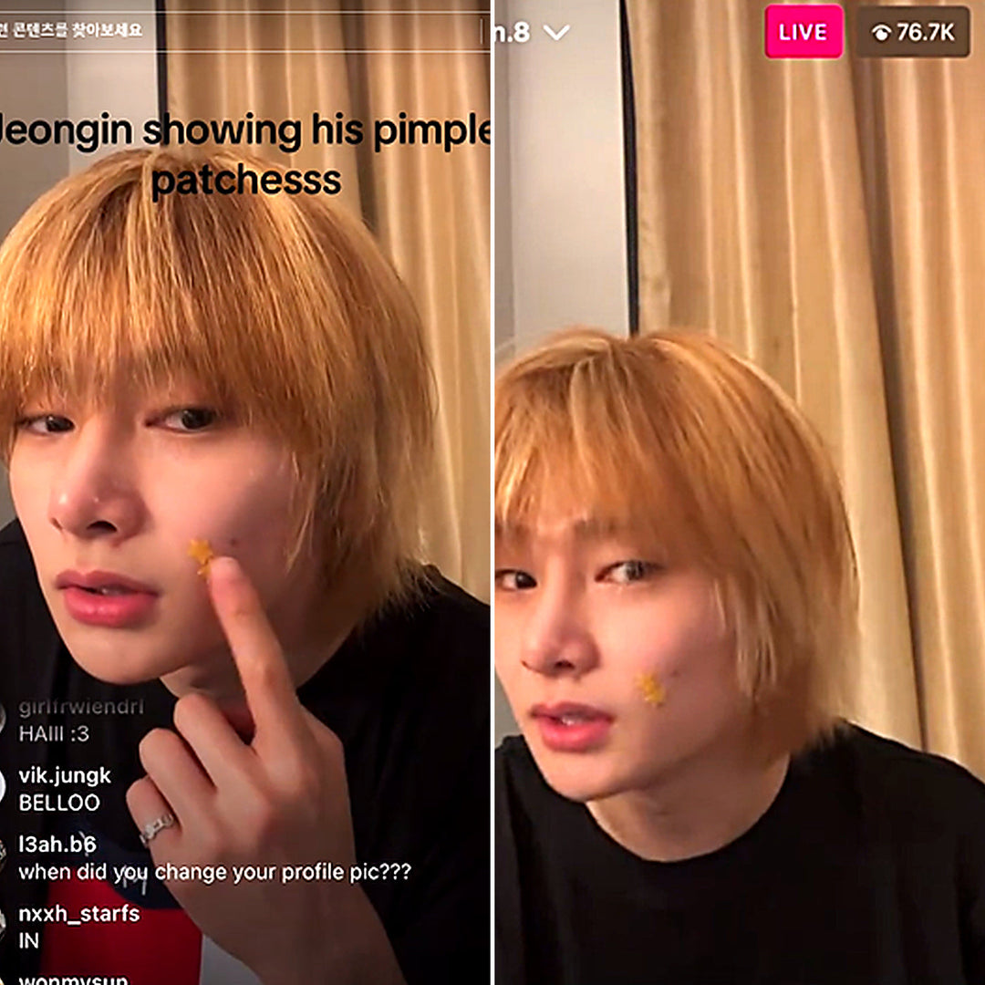 I.N Stray Kids wearing star shaped acne patch during live stream K-pop idol skincare routine