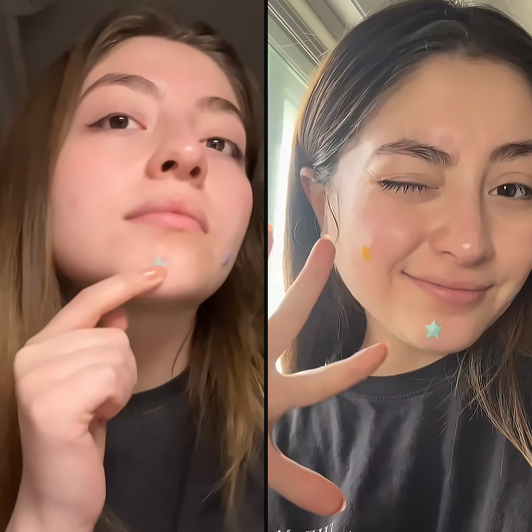 Valentina Paz @003waves wearing star-shaped acne patches — cute pimple patch K-beauty acne patch TikTok viral moment