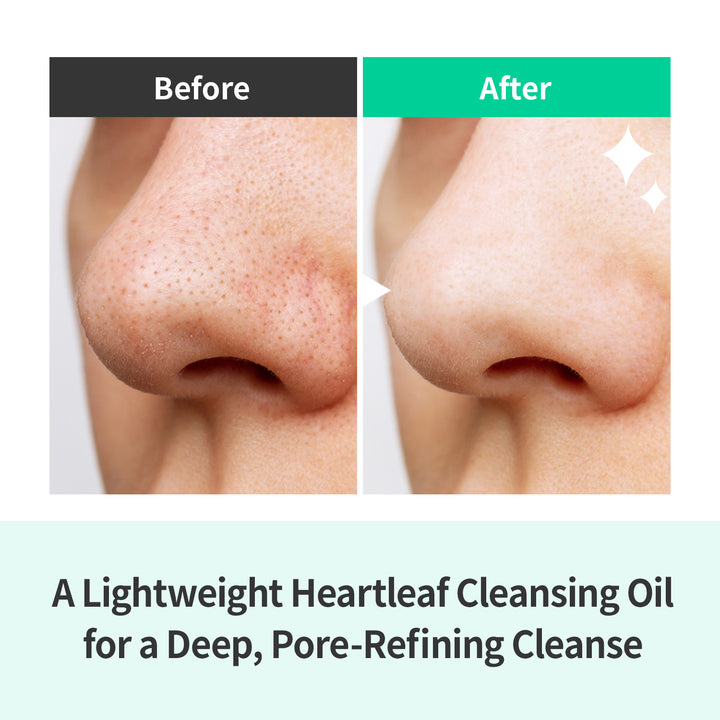 HeartLeaf Pore Zero Set