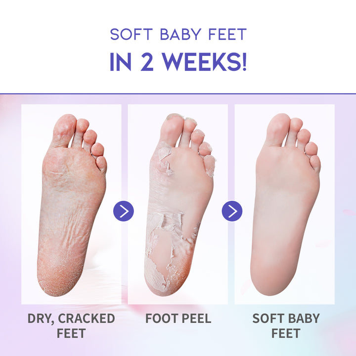 Lavender Therapy Foot Peel Mask (4pcs)